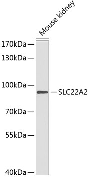 SLC22A2 Rabbit Polyclonal Antibody