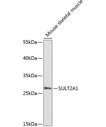SULT2A1 Rabbit Polyclonal Antibody