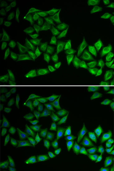 TPMT Rabbit Polyclonal Antibody