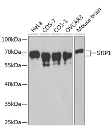 STIP1 Rabbit Polyclonal Antibody