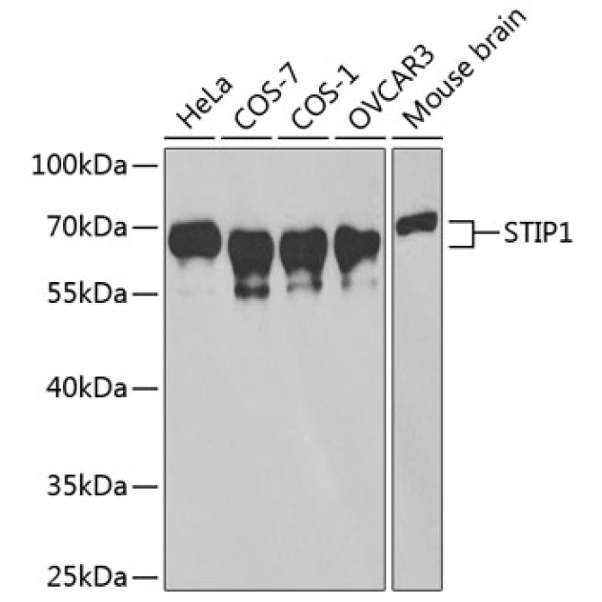 STIP1 Rabbit Polyclonal Antibody