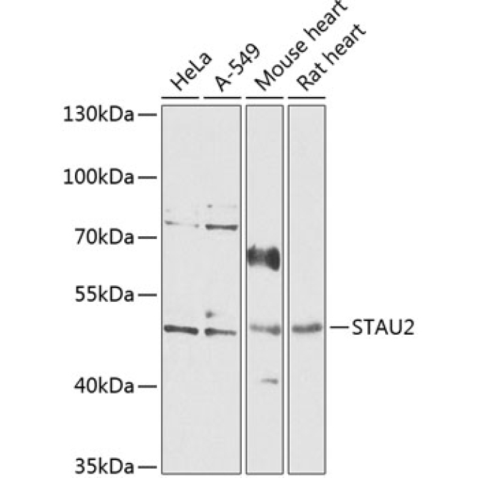 STAU2 Rabbit Polyclonal Antibody