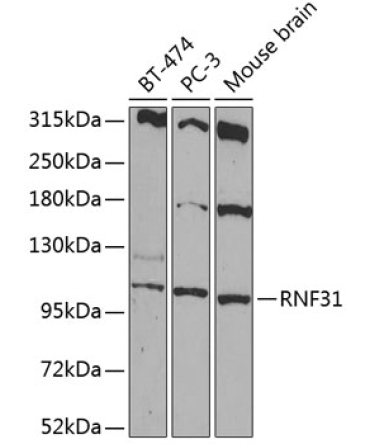 RNF31 Rabbit Polyclonal Antibody