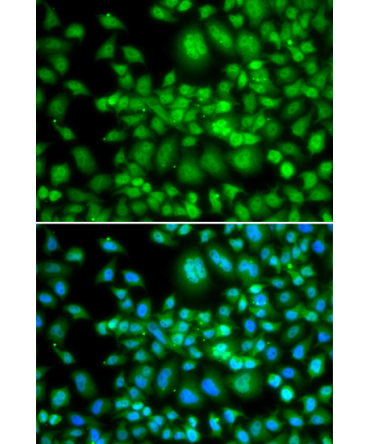 SETD5 Rabbit Polyclonal Antibody