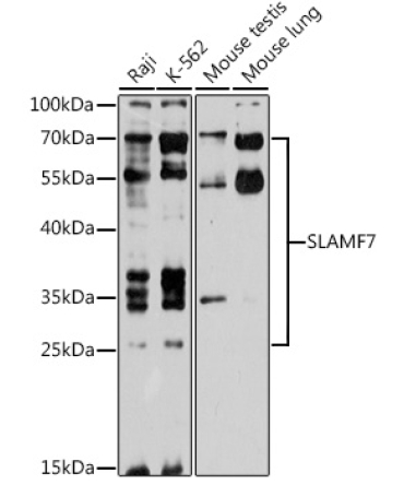 SLAMF7 Rabbit Polyclonal Antibody