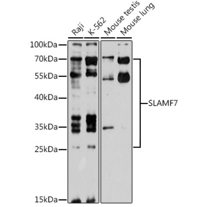 SLAMF7 Rabbit Polyclonal Antibody