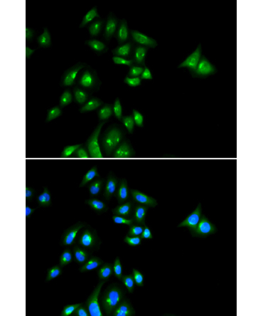 PHC3 Rabbit Polyclonal Antibody