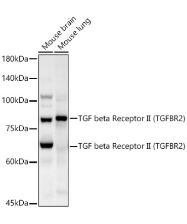 TGF beta Receptor II Rabbit Polyclonal Antibody