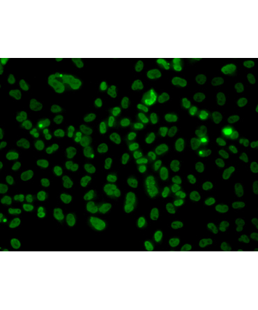 PLCXD2 Rabbit Polyclonal Antibody