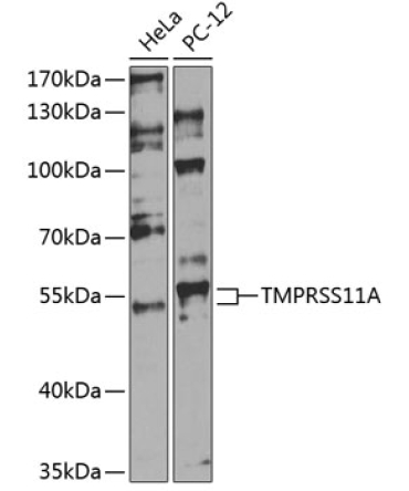 TMPRSS11A Rabbit Polyclonal Antibody
