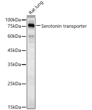Serotonin transporter Rabbit Polyclonal Antibody