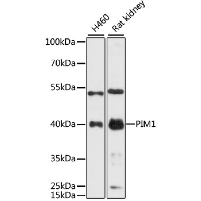 PIM1 Rabbit Polyclonal Antibody