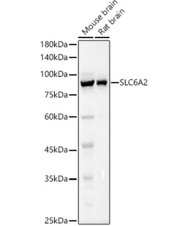 SLC6A2 Rabbit Polyclonal Antibody