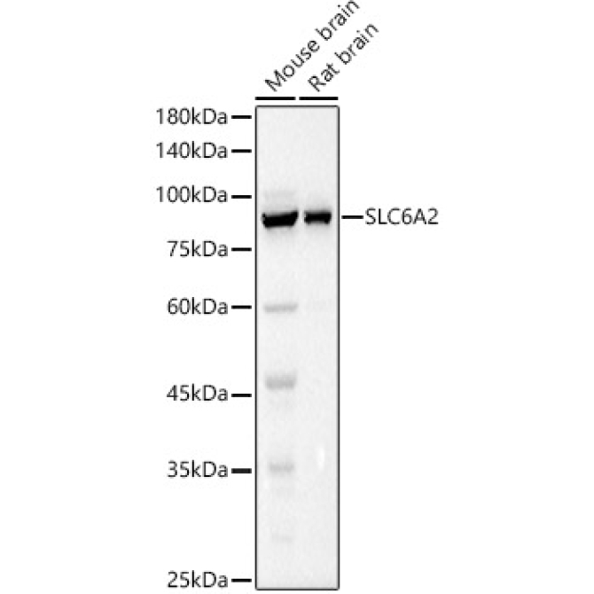 SLC6A2 Rabbit Polyclonal Antibody