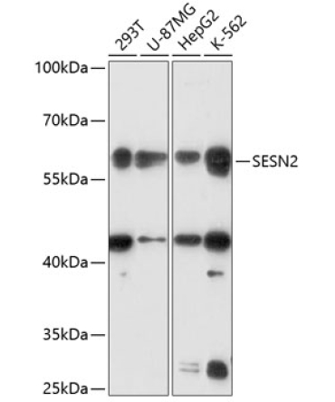 SESN2 Rabbit Polyclonal Antibody