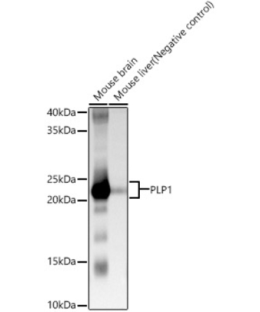 PLP1 Rabbit Polyclonal Antibody