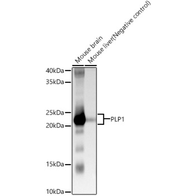PLP1 Rabbit Polyclonal Antibody