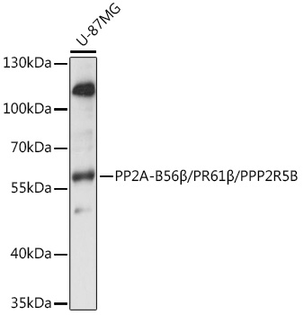 PP2A-B56Beta/PR61Beta/PPP2R5B Rabbit Polyclonal Antibody