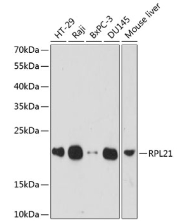 RPL21 Rabbit Polyclonal Antibody