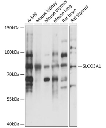 SLCO3A1 Rabbit Polyclonal Antibody