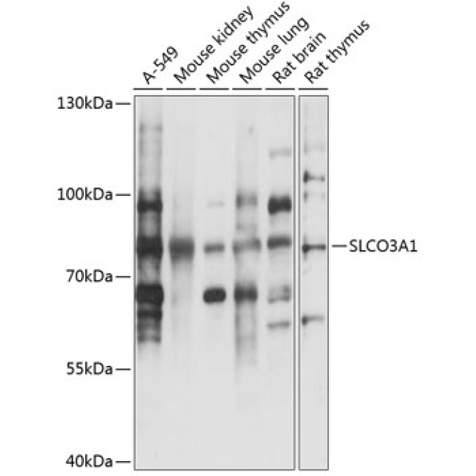 SLCO3A1 Rabbit Polyclonal Antibody