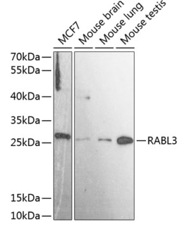 RABL3 Rabbit Polyclonal Antibody