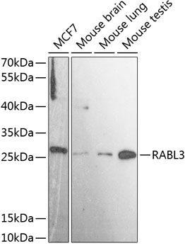 RABL3 Rabbit Polyclonal Antibody