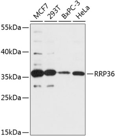 RRP36 Rabbit Polyclonal Antibody