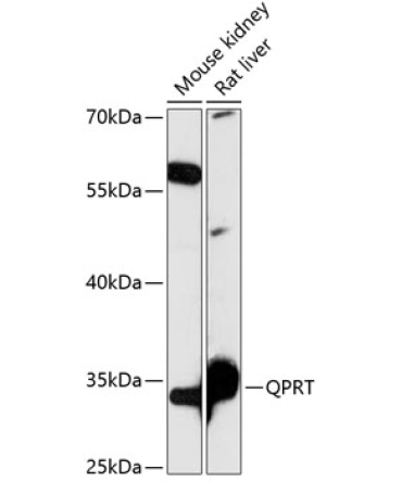 QPRT Rabbit Polyclonal Antibody