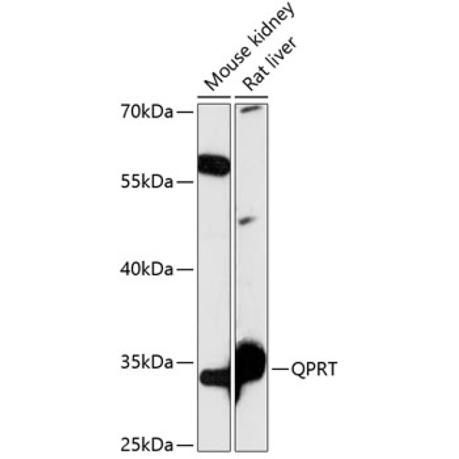 QPRT Rabbit Polyclonal Antibody