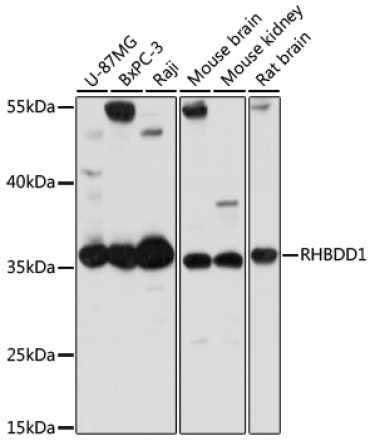 RHBDD1 Rabbit Polyclonal Antibody