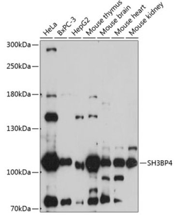 SH3BP4 Rabbit Polyclonal Antibody