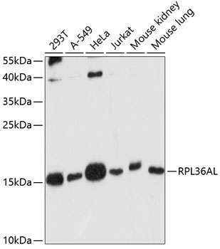 RPL36AL Rabbit Polyclonal Antibody
