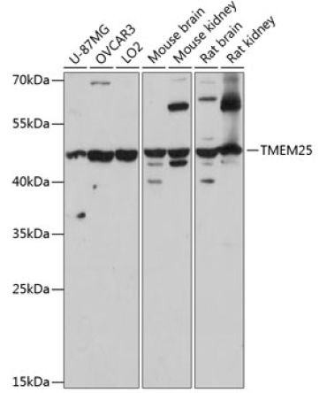 TMEM25 Rabbit Polyclonal Antibody