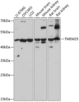 TMEM25 Rabbit Polyclonal Antibody