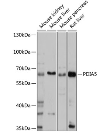 PDIA5 Rabbit Polyclonal Antibody