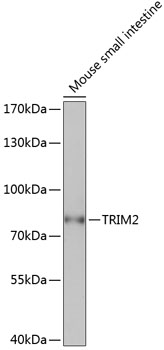 TRIM2 Rabbit Polyclonal Antibody