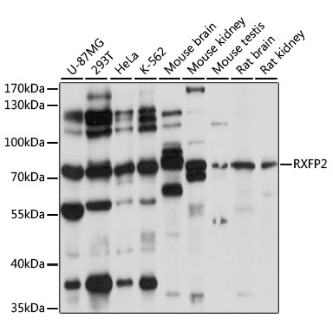 RXFP2 Rabbit Polyclonal Antibody