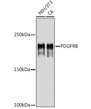 PDGFRB Rabbit Polyclonal Antibody