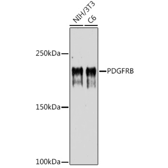 PDGFRB Rabbit Polyclonal Antibody