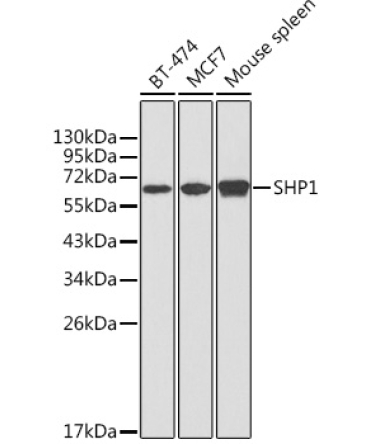 SHP1 Rabbit Polyclonal Antibody