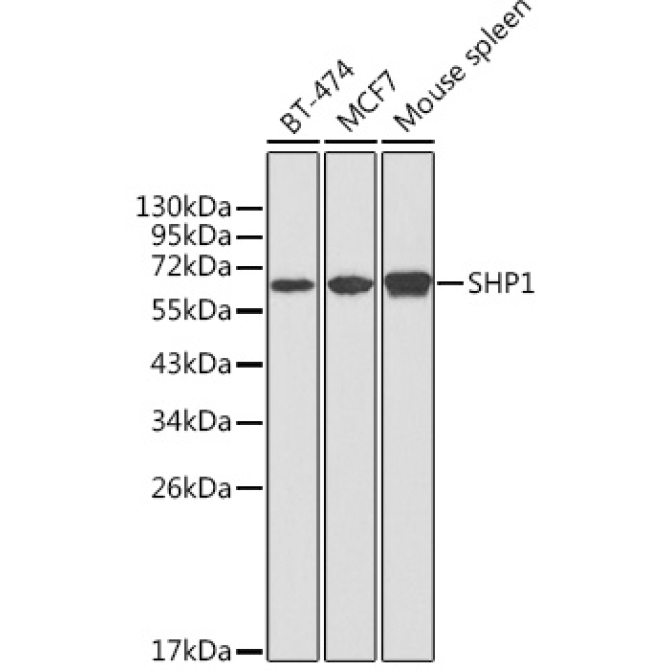 SHP1 Rabbit Polyclonal Antibody