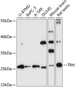 TRH Rabbit Polyclonal Antibody