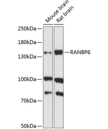 RANBP6 Rabbit Polyclonal Antibody