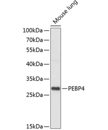 PEBP4 Rabbit Polyclonal Antibody