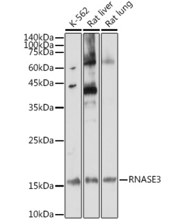 RNASE3 Rabbit Polyclonal Antibody