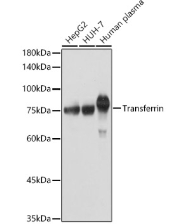 Transferrin Rabbit Polyclonal Antibody