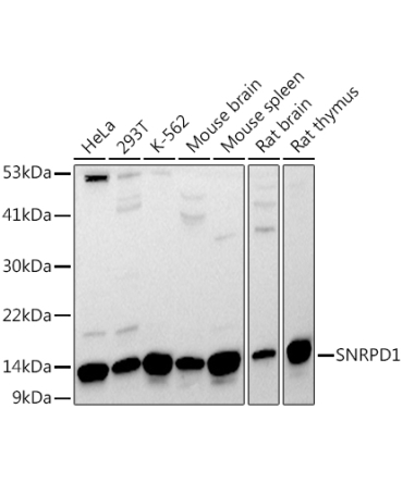 SNRPD1 Rabbit Polyclonal Antibody
