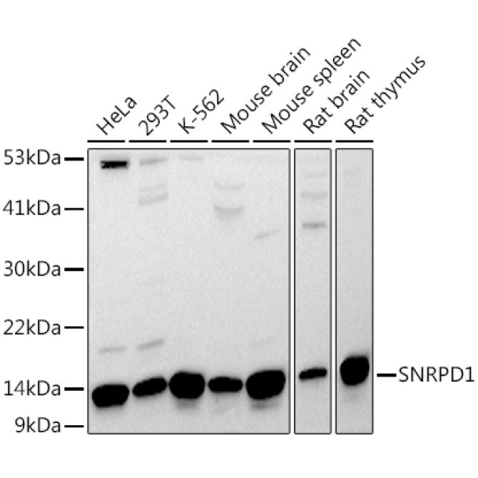 SNRPD1 Rabbit Polyclonal Antibody