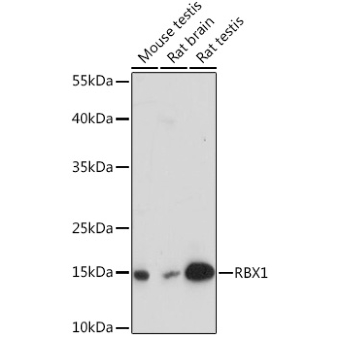 RBX1 Rabbit Polyclonal Antibody